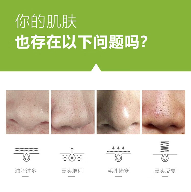 依姿卡丽绿茶控油吸纷刺鼻贴膜10片装 绿茶控油清爽祛黑头鼻贴膜 1盒