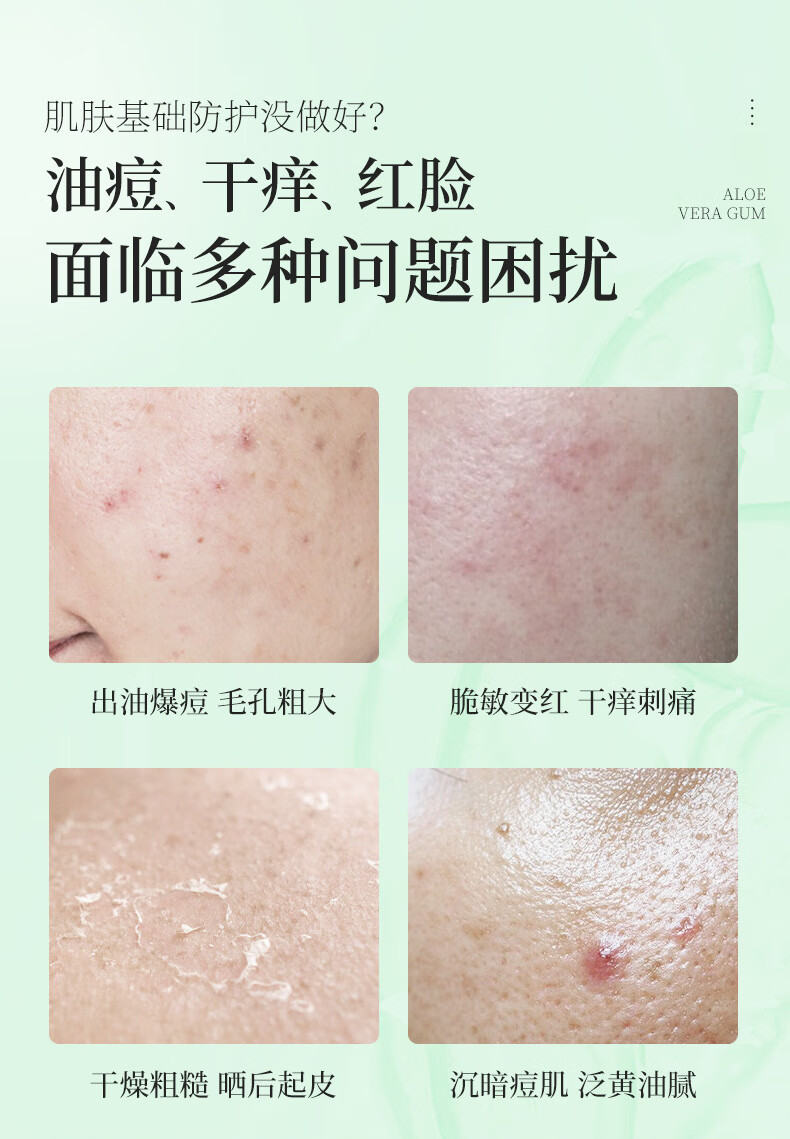 碧然堂芦荟胶500ml补水保湿晒后面霜凝胶男女士面部滋润嫩肤身体护理乳 【大容量】舒缓芦荟胶500ml