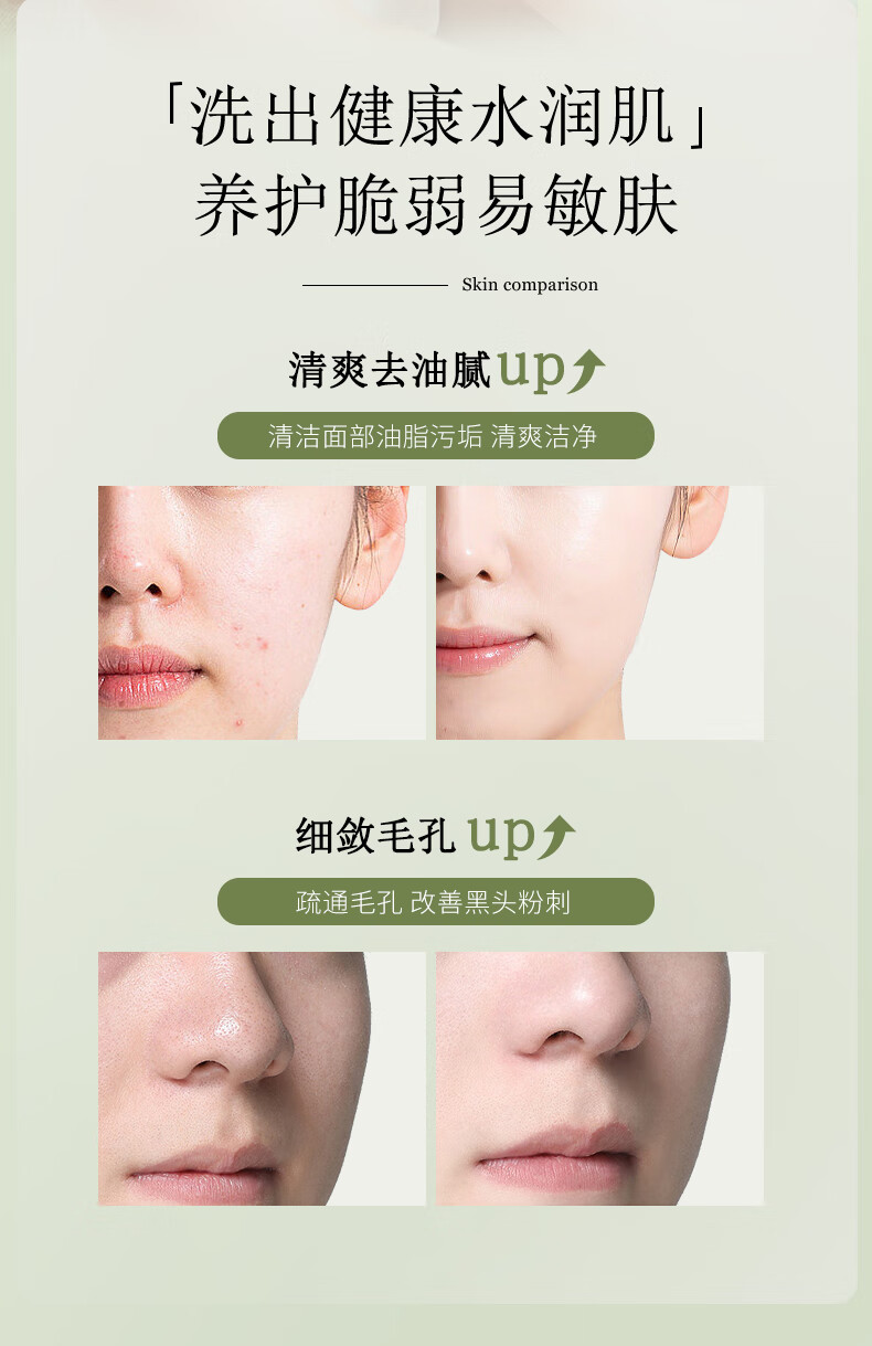 碧然堂洁面氨基酸洗面奶100g舒颜洁面乳保湿洗面奶清洁油皮痘肌男女士 100g