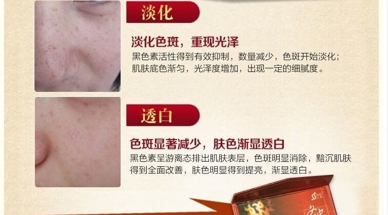 韩泊莉笑影冬虫夏草二合一美白祛斑霜套装淡斑保湿黄褐斑雀斑化妆品 日霜+日霜