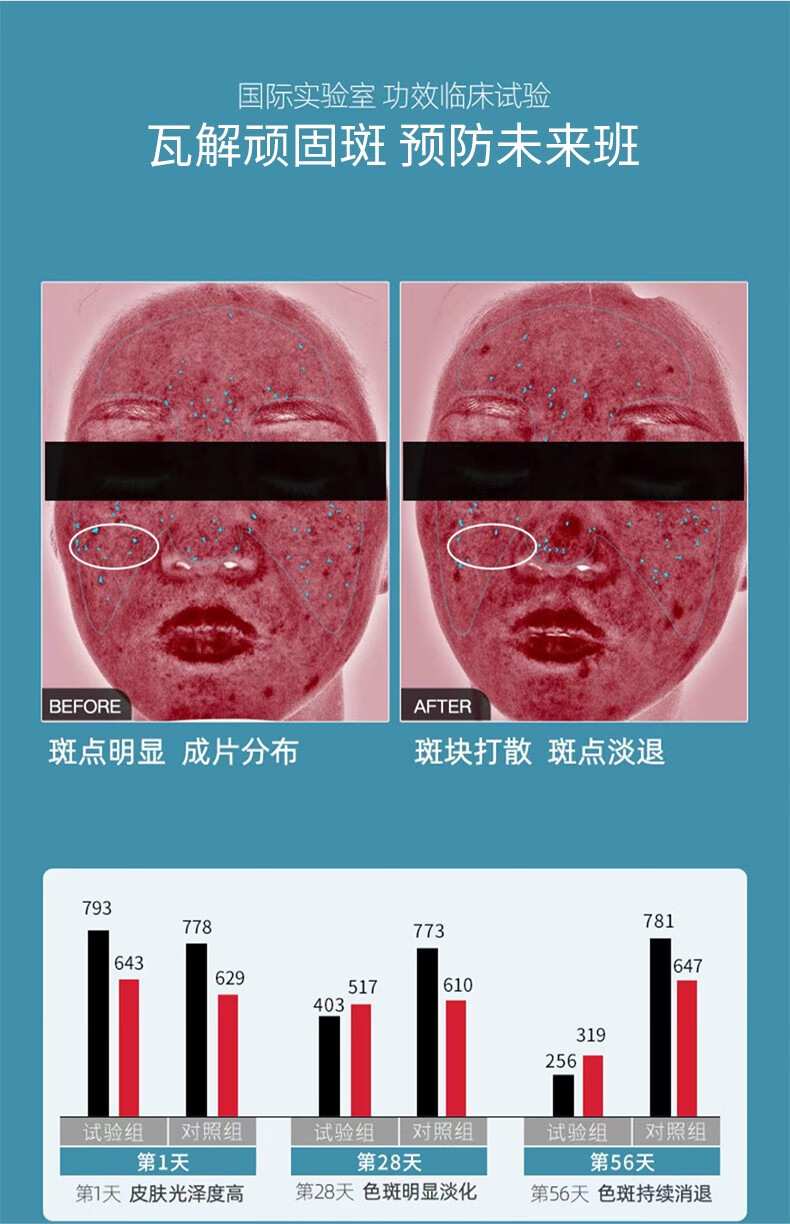 花恩诗美白祛斑霜 雀斑妊娠斑老斑黄褐年斑祛斑保湿补水护肤素颜面霜 二盒【轻度祛斑】