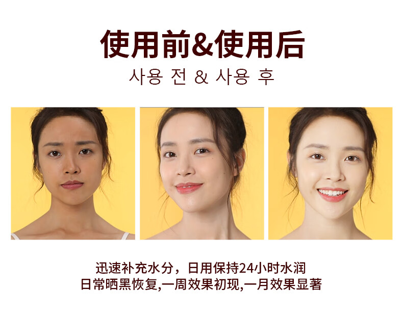 Tondi水杨酸精华液净痘痘淡化痘印痘疤粉刺闭口面部精华青春痘护肤品 30ml