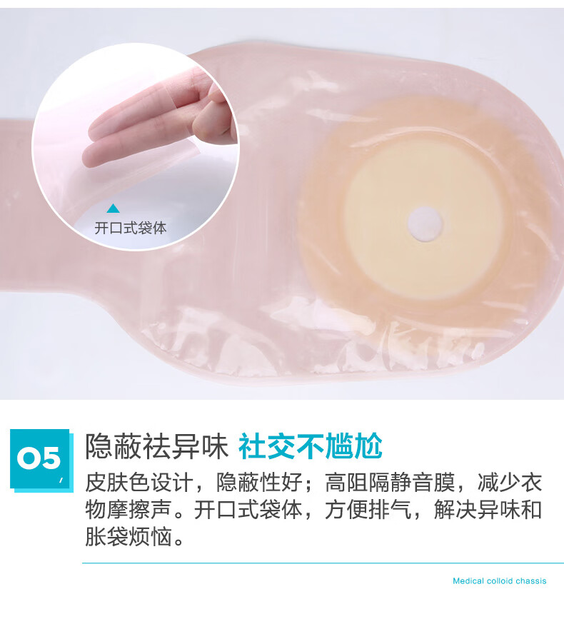 zotoyl一件式肛门直肠改道大便造瘘袋一次性肛袋粪袋口袋肛肠造漏造口