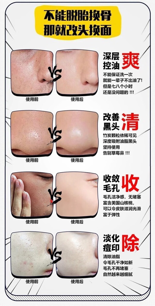 九叶草氨基酸洗面奶男女男士洗面奶除螨控油去黑头去角质收缩毛孔 1瓶装【脸上瘙痒长痘螨虫在作怪
