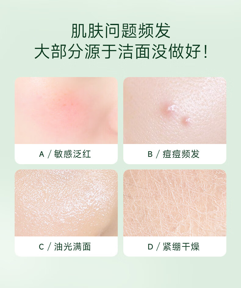妍诗美（acymer）茶树氨基酸洁颜蜜温和洗面奶洗脸卸妆合一洁面乳敏感肌男女伊的家 120g