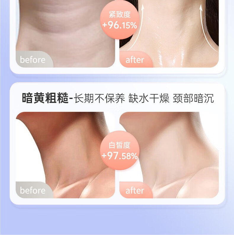 妮丽雅定制款颈膜固定带可水洗颈部敷脖子面膜颈带绑带颈纹带辅助工具 香芋粉黛【不卡不勒脖子】