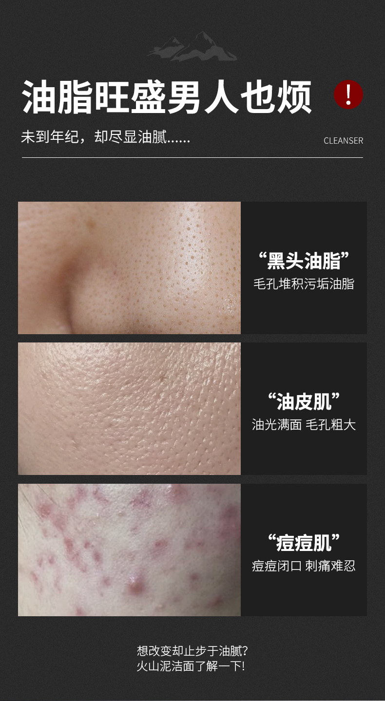 梵贞 男士洗面奶补水保湿控油去角质淡化黑头洁面乳深层清洁去油粉刺 男士劲肤控油洁面乳168g