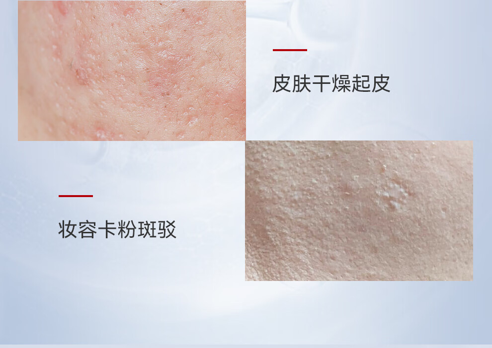 御简（UJ.LINCO）精萃水补水爽肤水保湿水舒缓镇静湿敷水玻尿酸毛孔收缩屏障修护 150ml