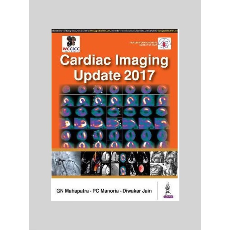 按需印刷Cardiac Imaging Update 2017[9789386322937]