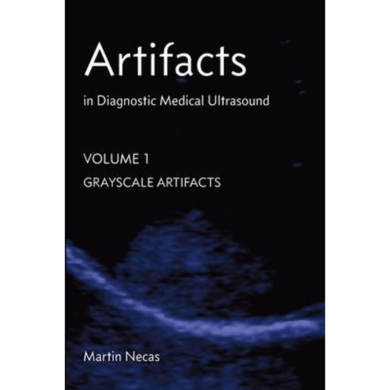 按需印刷Artifacts in Diagnostic Medical Ultrasound[9780987292162]