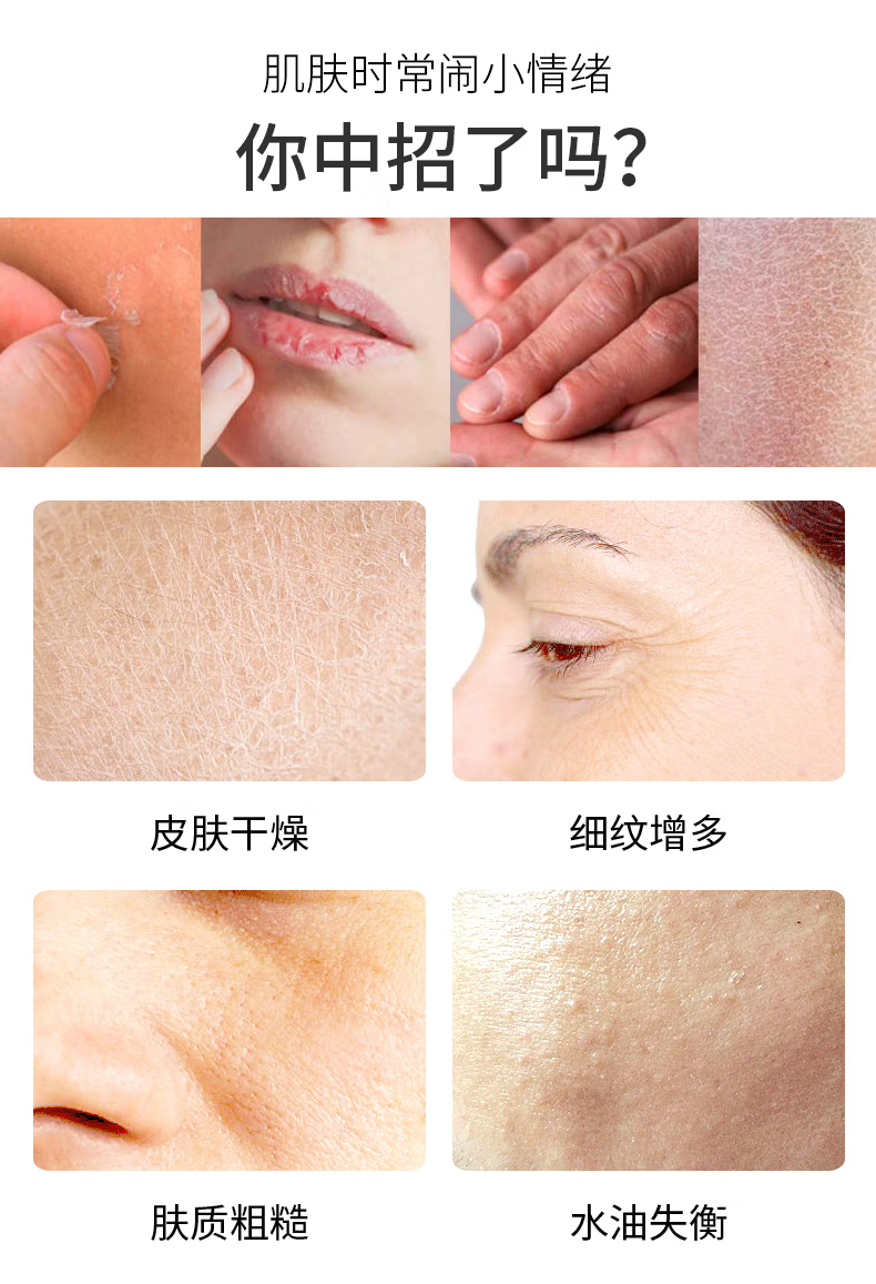 媛后 维生素E乳VE身体乳液面霜秋冬季保湿补水滋养敏肌肤护肤乳护手霜 经典维生素E乳*3瓶