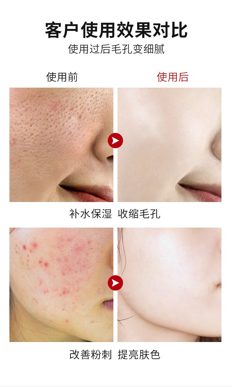 人 仁和匠心收缩毛孔精华液原液细致毛孔粗大脸部保湿补水男女通用 100ml*3瓶