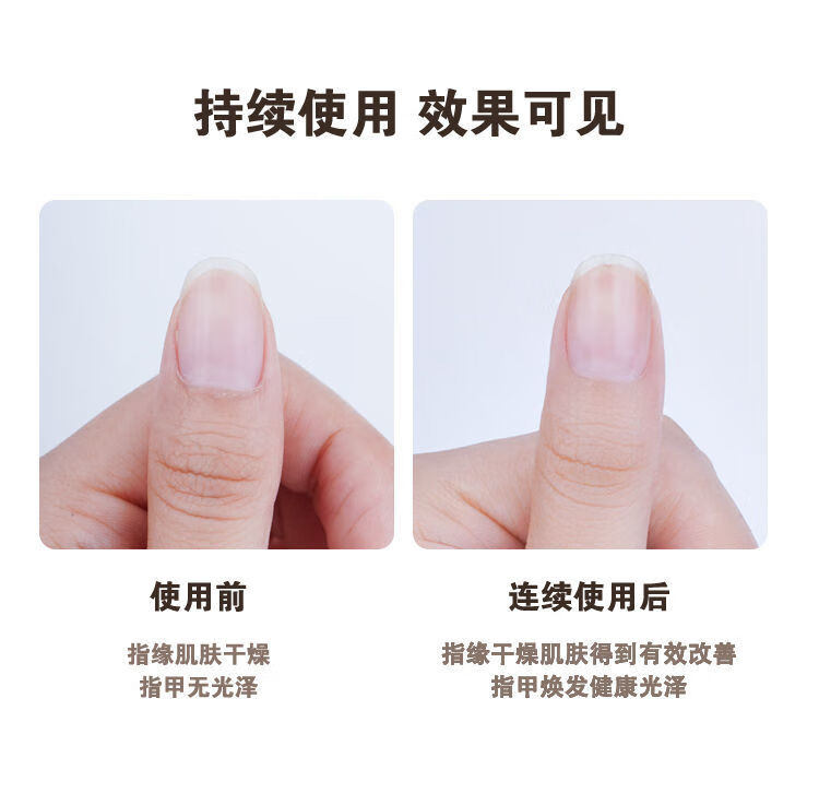 韩泊莉妖制护甲油指缘油边缘防倒刺死皮营养精油指甲修复受损美甲免烤 4.5ml每只