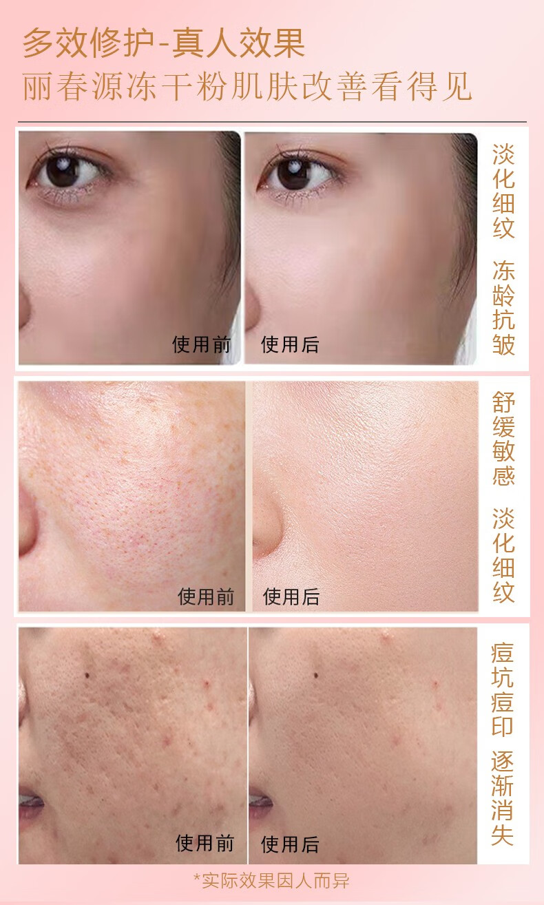 丽春源暨大院线多肽修护舒缓保湿通用敏肌淡纹细腻毛孔美肌冻干粉 冻干粉
