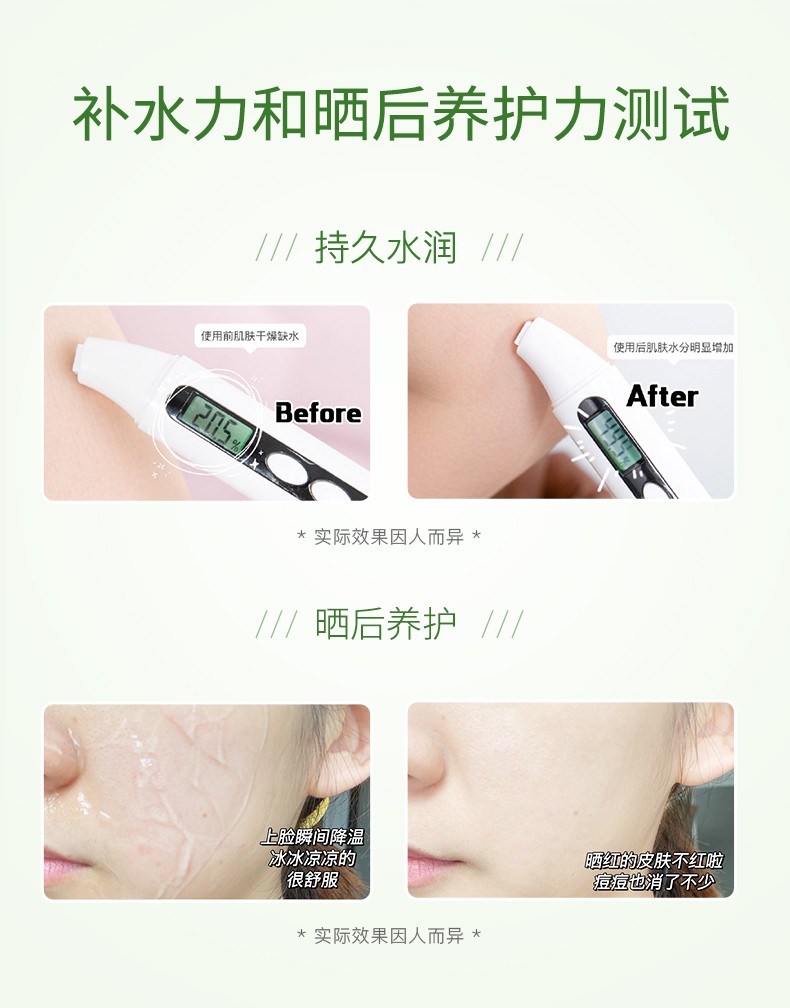 瑷露德玛芦荟胶膏清修痘护淡化痘印清爽晒后呵护护肤品芦荟凝胶200g 两件套（200g凝胶+240ml原液）