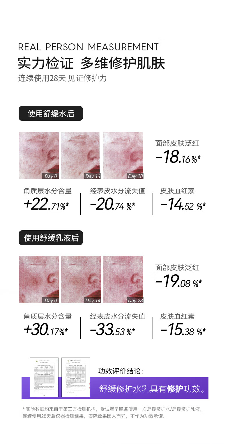 德妃（DERMAFIRM）新款紫苏水乳套装保湿补水护肤品控油皮清爽舒缓紫苏水女化妆 3.0新款 紫苏水150ml