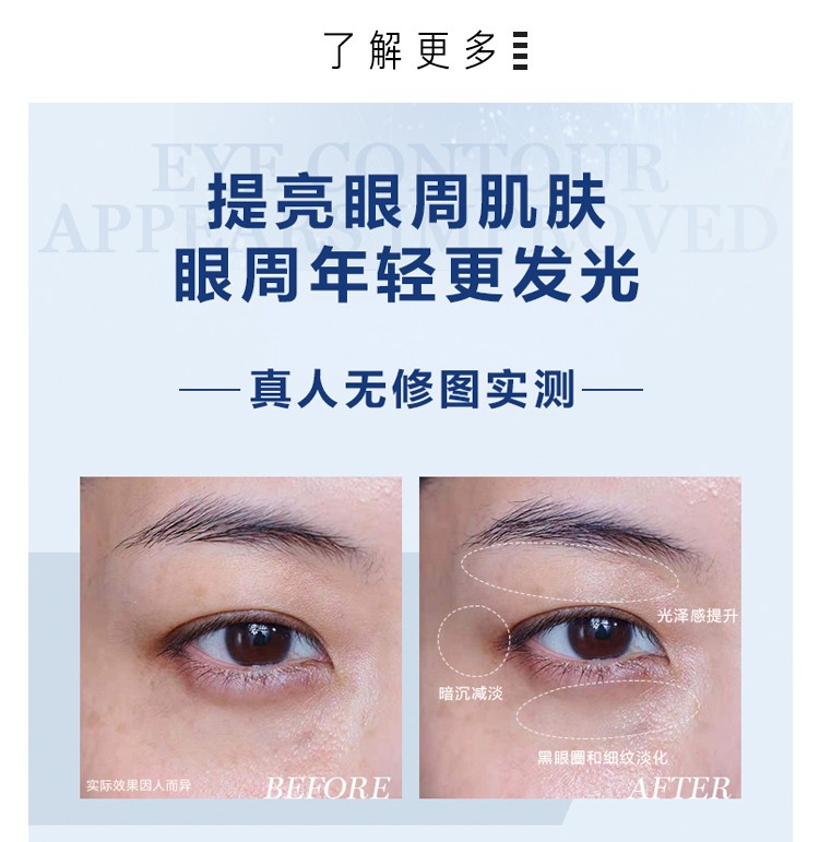 焱蜀（精选好物）小黑瓶发光眼霜淡纹紧致淡黑眼圈15ml