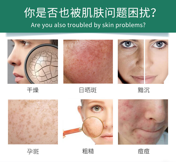 维怡美花开八度官方正1品旗舰1店根草原液根果精华液养颜套装面膜冻干粉 根草原液III（20ml）+赠棉签