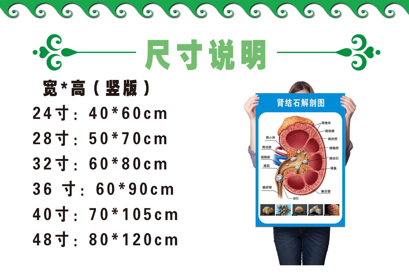 肾结石泌尿结石解剖图医学宣传挂图人体器官结构图医院海报墙贴纸泌尿