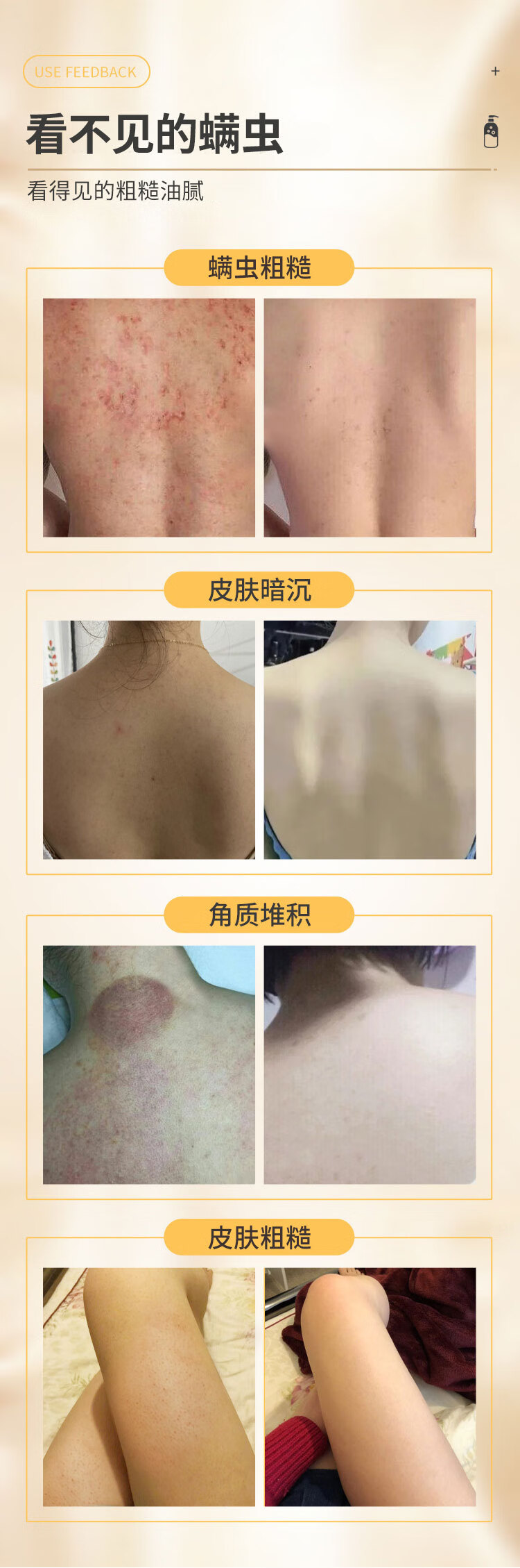 硫磺除螨沐浴露螨虫后背痘痘祛控油去多效沐浴皂液露滋润硫磺液体香皂男女 硫磺沐浴露x2瓶
