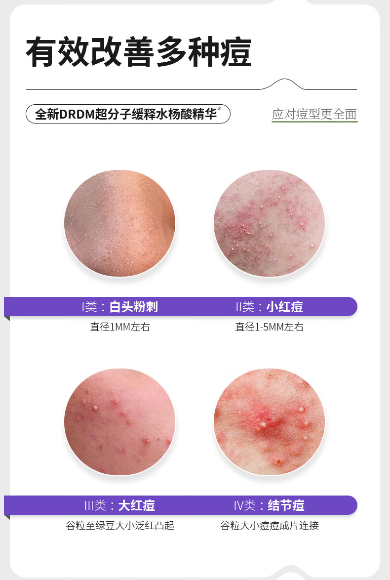 DRDM祛痘精华液水杨酸抗痘去闭口粉刺修护痘肌原液控油淡化痘印 20ml