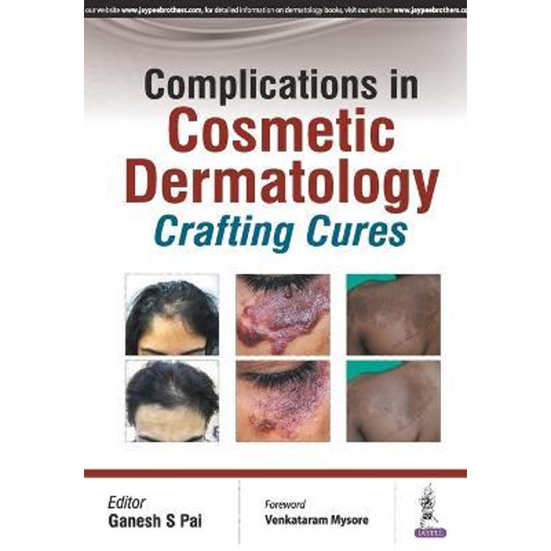 按需印刷Complications in Cosmetic Dermatology[9789385891878]