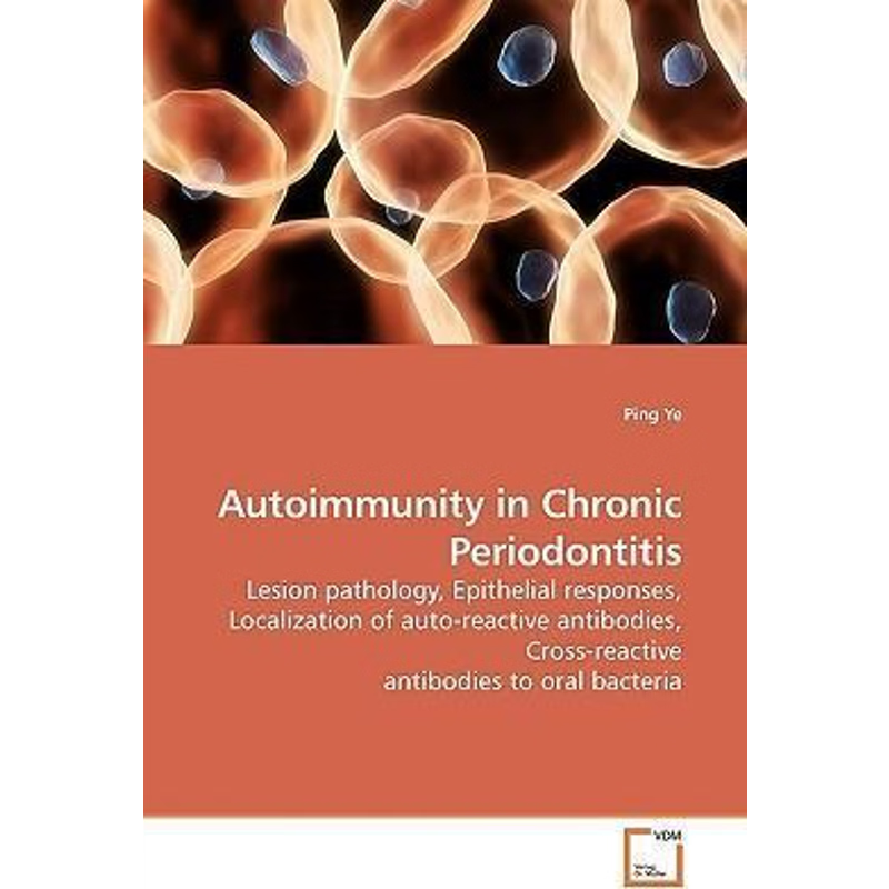 按需印刷不退不换Autoimmunity in Chronic Periodontitis[9783639192773]