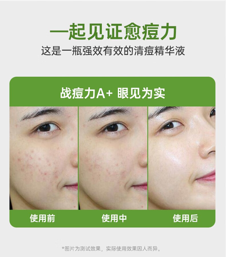 珂语（KEYU） 清痘调理凝胶焕颜祛痘精华净粉刺修护痘肌控油收敛毛孔 清痘调理凝胶1盒6支