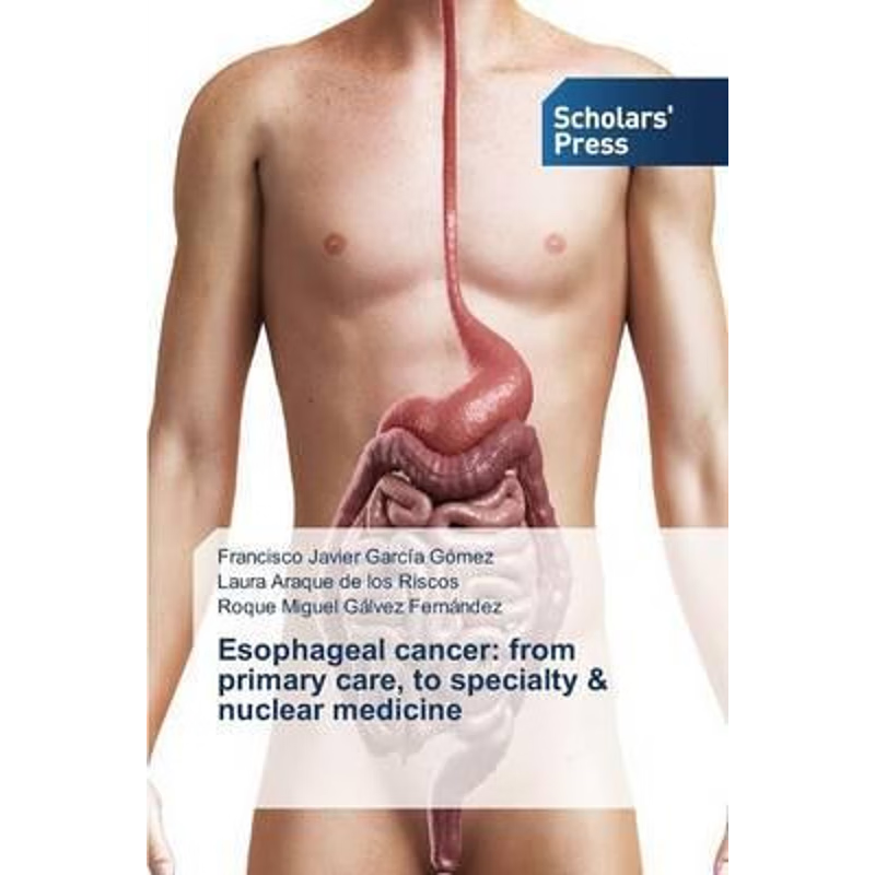 按需印刷Esophageal cancer[9783639860672]