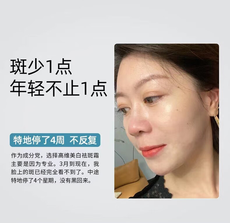 花恩诗美白祛斑霜 雀斑妊娠斑老斑黄褐年斑祛斑保湿补水护肤素颜面霜 二盒【轻度祛斑】
