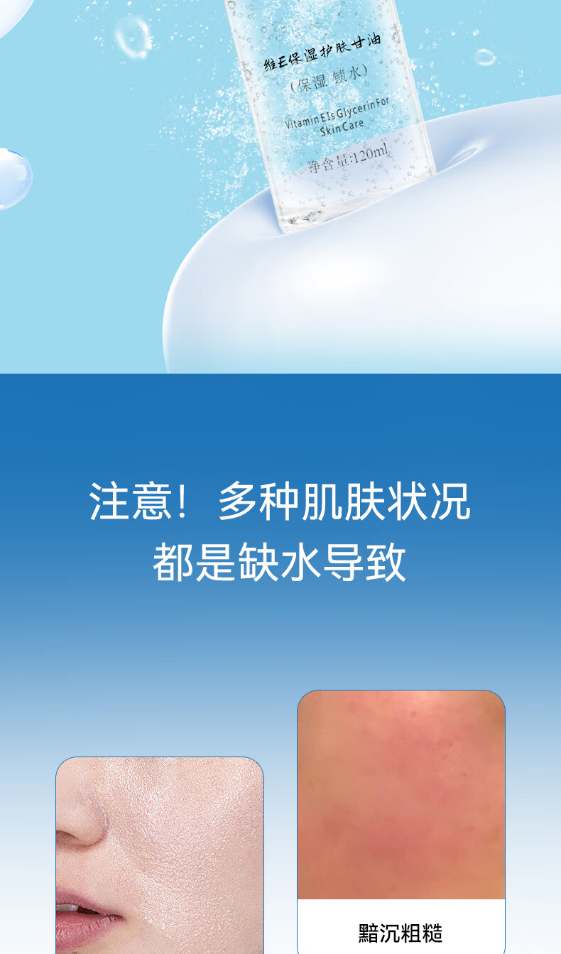 伊渼雅维生素E护肤甘油嫩肤滋润保湿精华补水脸部不卡粉清爽滋润伊美雅 3瓶360ml