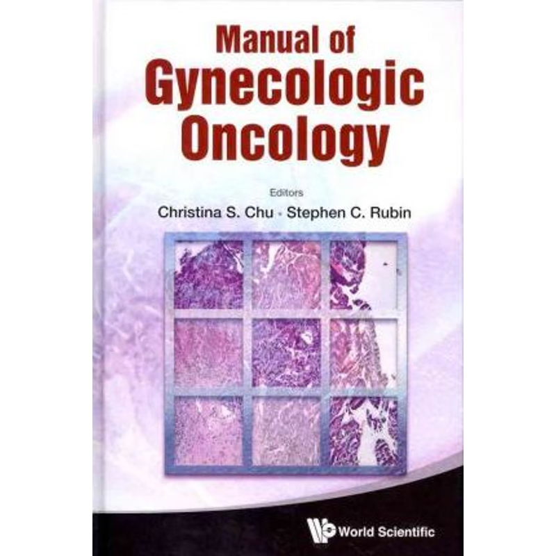 按需印刷Manual of Gynecologic Oncology[9789814343695]