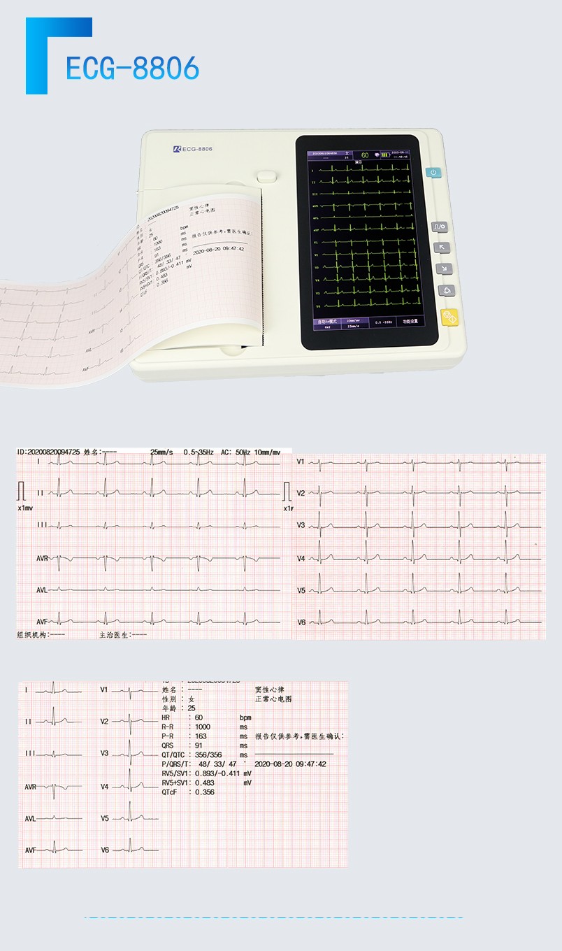 触屏数字式心电图机3-6道心电报告监测仪医用 ecg-8806 更多参数>>