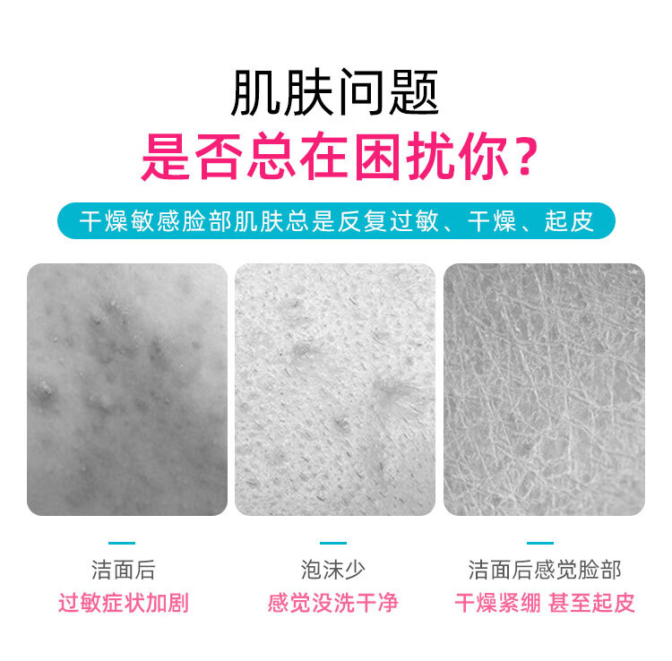 多芬洗面奶女氨基酸洁面清洁毛孔敏感肌温和保湿慕斯泡沫男 160ml