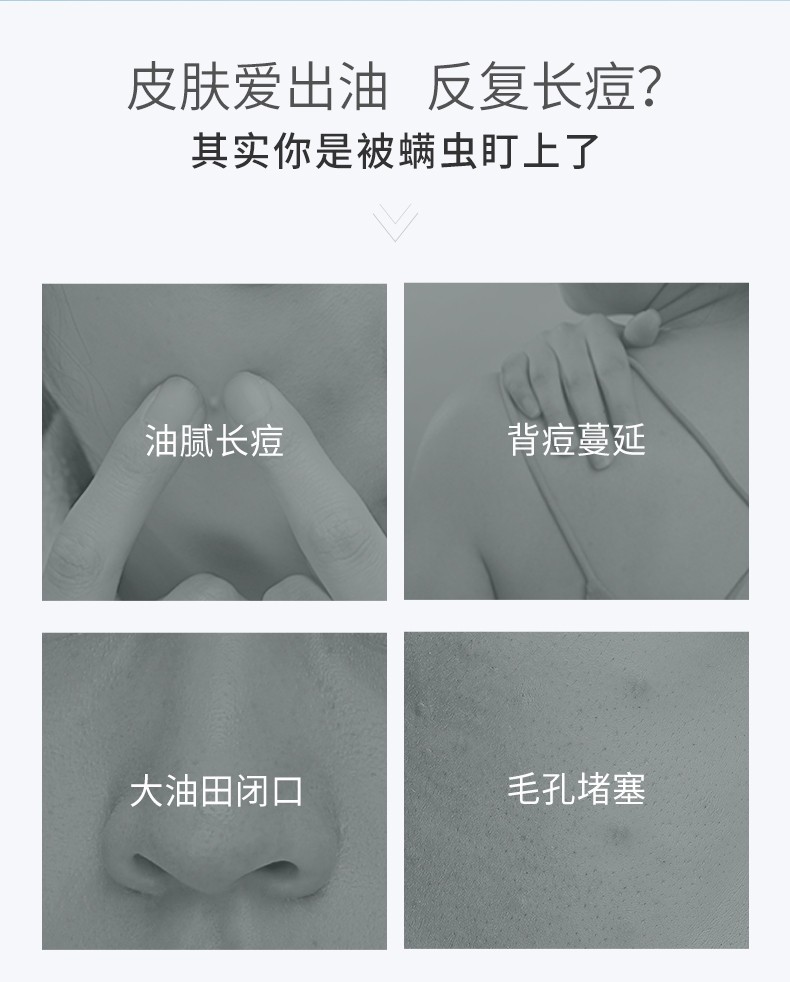 雪玲妃芝士皂海盐除螨净痘皂男女士洗脸洗澡拉丝除痘祛痘洁面去螨虫香皂学生手工肥皂 100g 一盒