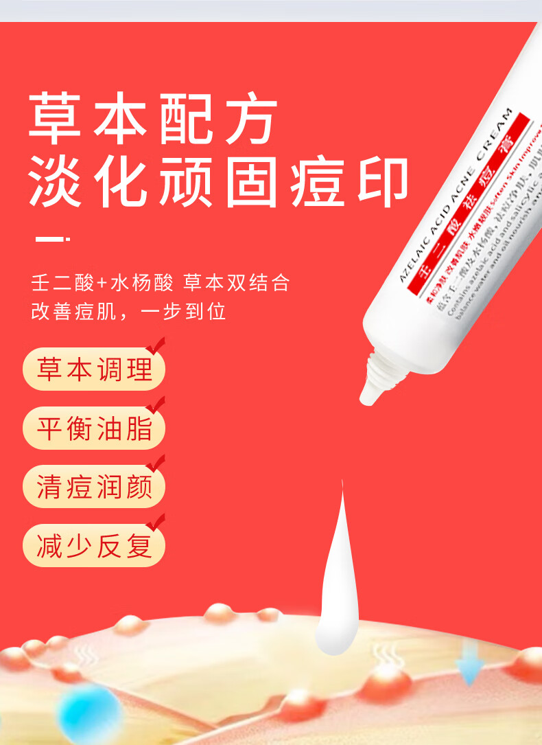 RYDEEN壬二酸祛痘膏凝胶淡化痘印痘坑青春痘成人痘粉刺黑头抗痘 1支