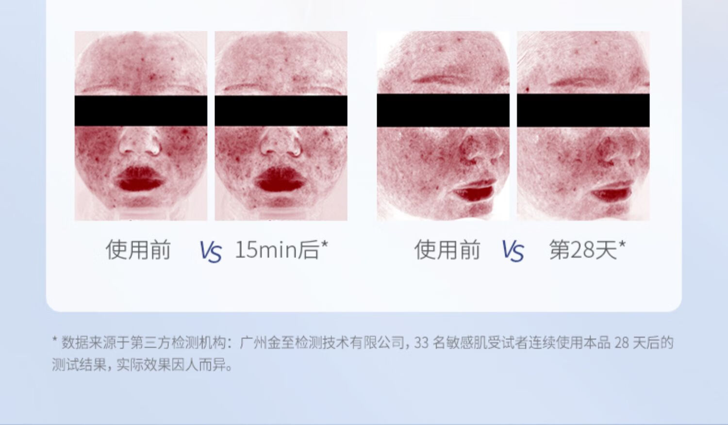 赫宝仙媞面膜次抛精华试用装玻色因重组胶原蛋白修护舒缓补水保湿敏感肌 面膜+屏障次抛1支【王炸组合】