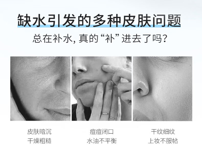 吟美维生素E乳液VE润肤霜b5身体乳男女面部保湿秋冬缓解瘙痒干燥滋润 维生素保湿霜x6瓶