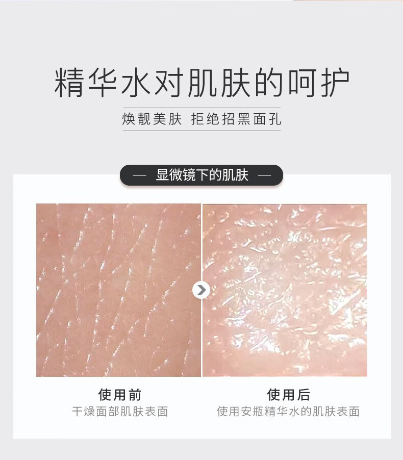 色娜娜 润透精华水护肤湿敷化妆保湿补水滋润烟酰胺精华水 500ml/瓶