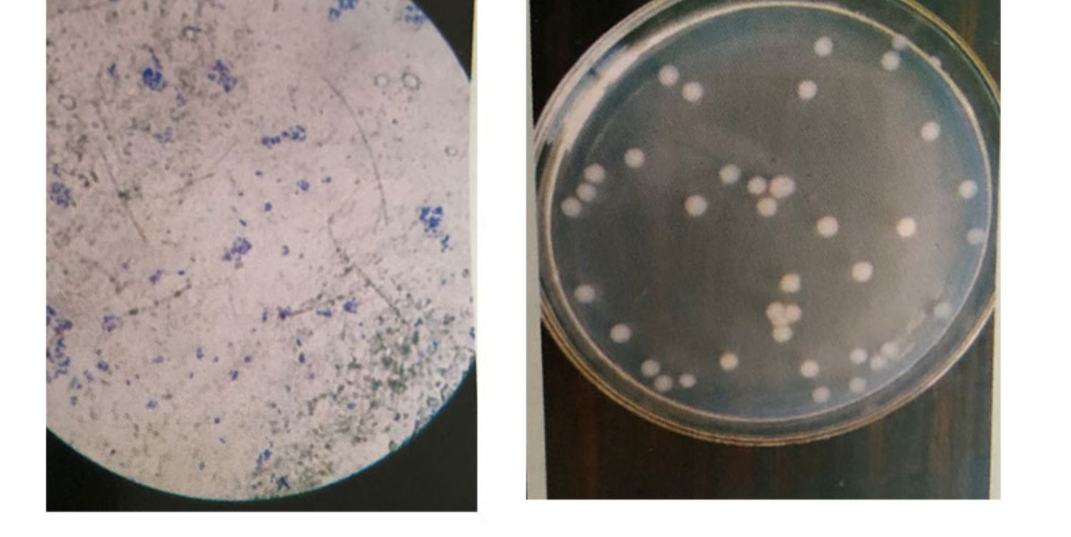 污水处理菌种好氧菌剂厌氧复合菌净水微生物污泥生化菌除c氨氮空白