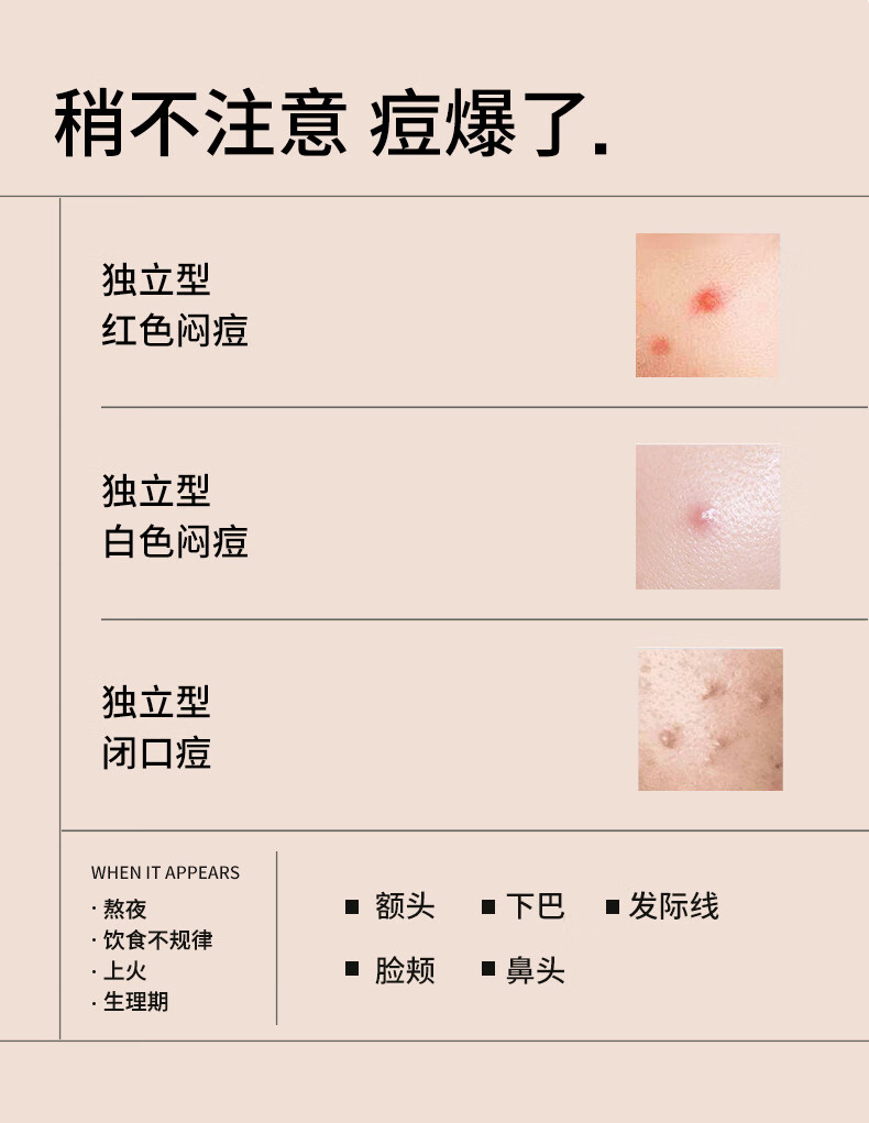 樊文花（fawa） 樊文花3号祛痘精华液3%包裹水杨酸清爽快祛痘控油修护熬夜油痘肌 20ml