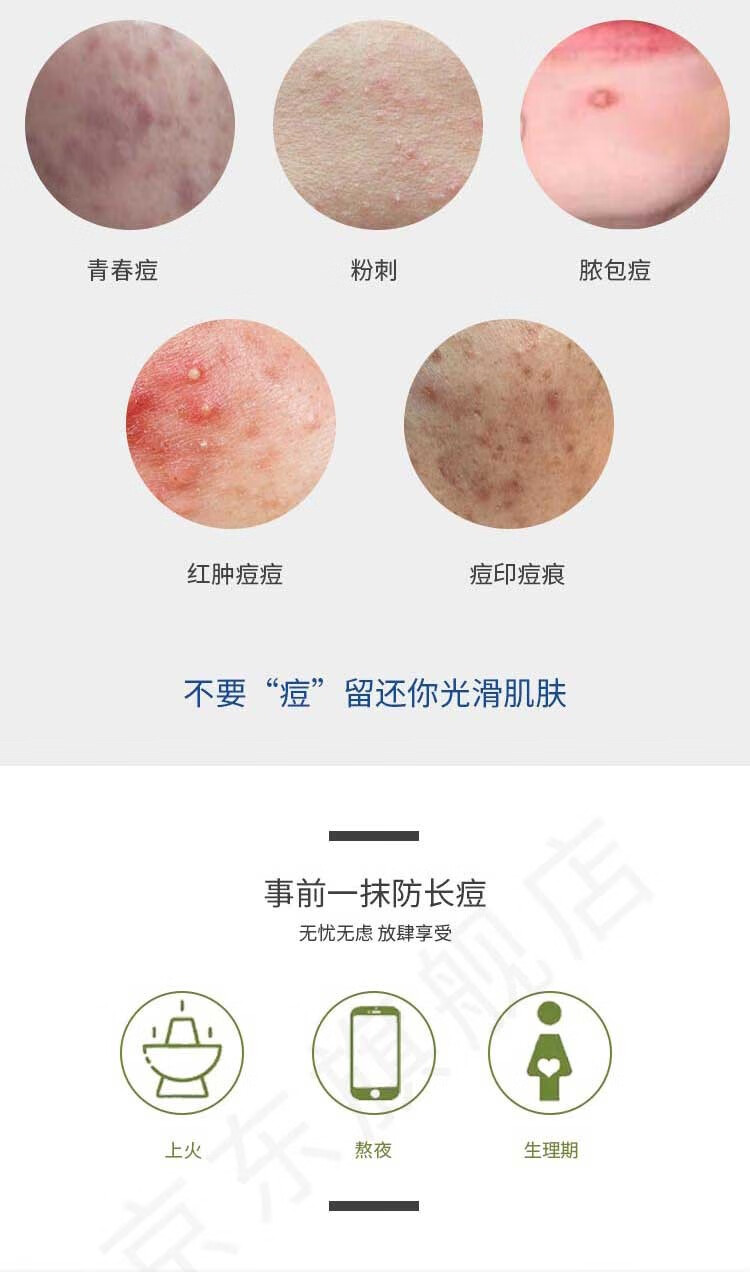 精心 协和医院祛痘精华霜粉刺痘印青春痘 点痘笔洗面奶高初中男女学生 【净豆洁面啫喱（青春痘 粉刺】