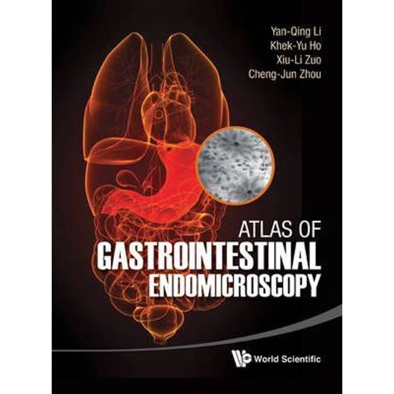 按需印刷Atlas of Gastrointestinal Endomicroscopy[9789814366656]