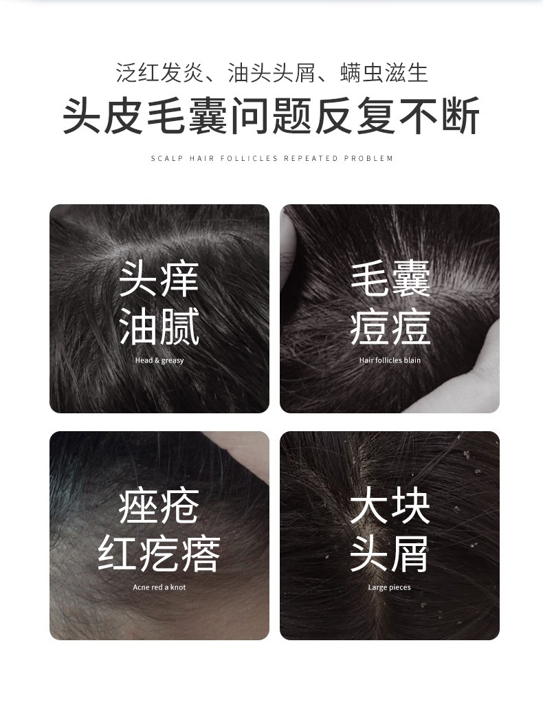 人 仁和匠心头皮毛囊洗发水炎除螨去屑止痒深层清洁头部油脂洗发露 一瓶