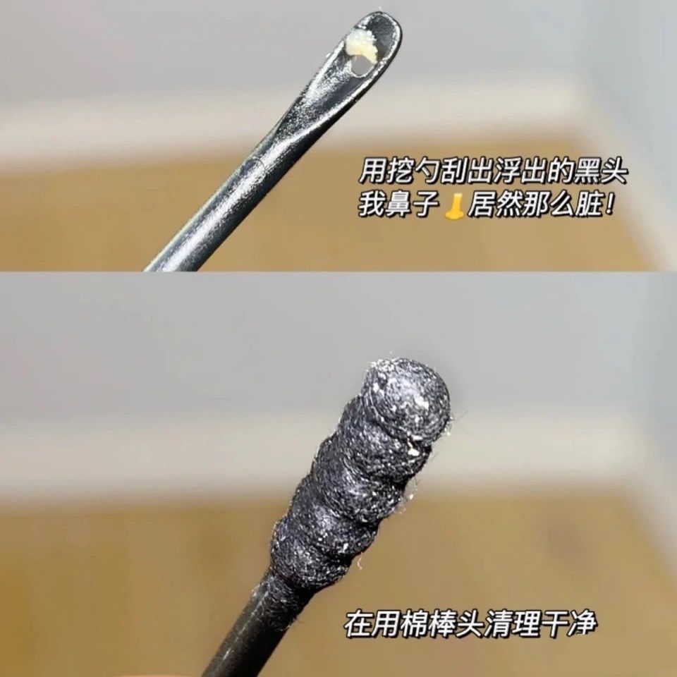 一次性去黑头粉刺刮黑头双头棉签棒工具清洁掏耳朵挤痘棒【双头】