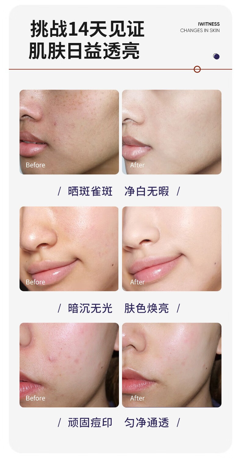 Drve面膜女虾青素抗氧烟酰胺提亮去暗沉补水保湿紧致嫩肤控油修护熬夜 烟酰胺面膜5片/盒（到手5盒）