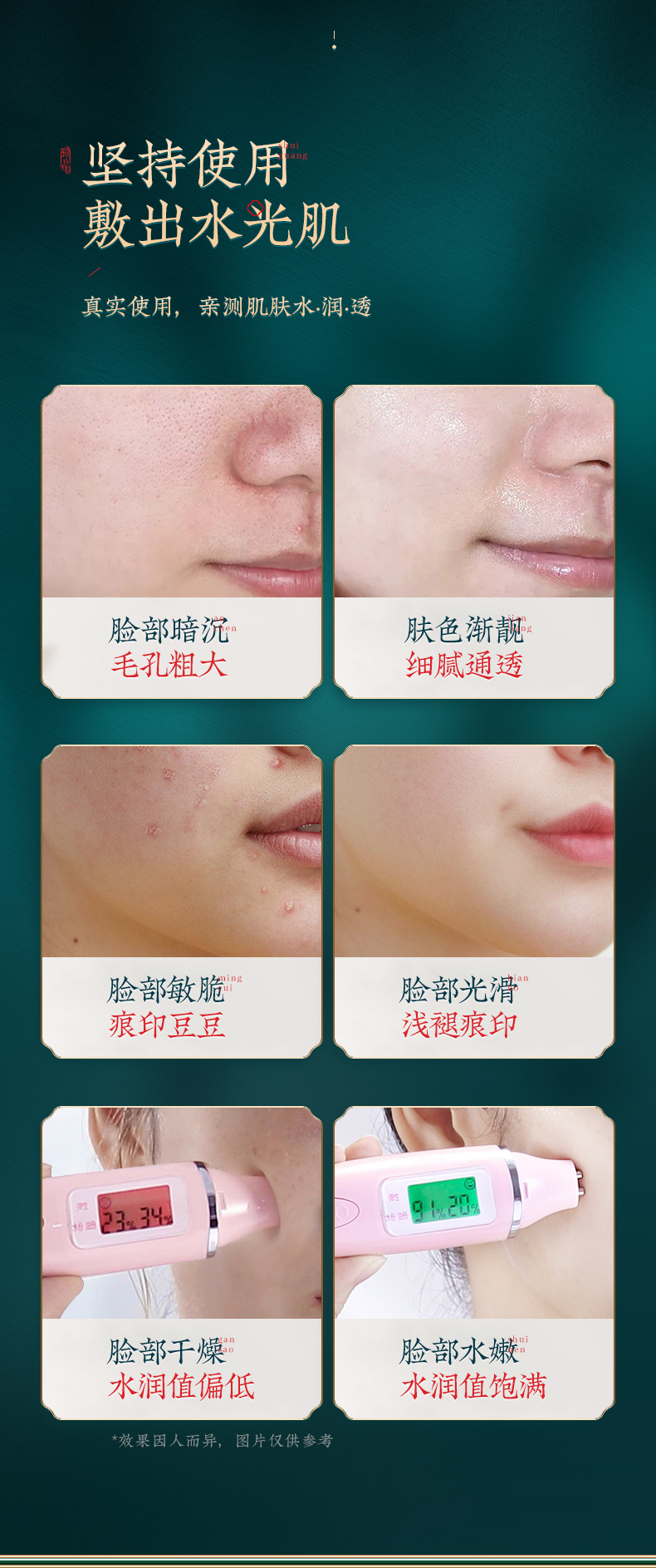 冰菊（Bing Ju） 御廷五珍水光精萃面膜补水保湿滋润肌肤 五珍套装