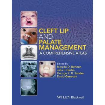 【预订】cleft lip and palate management【摘要 书评 试读】