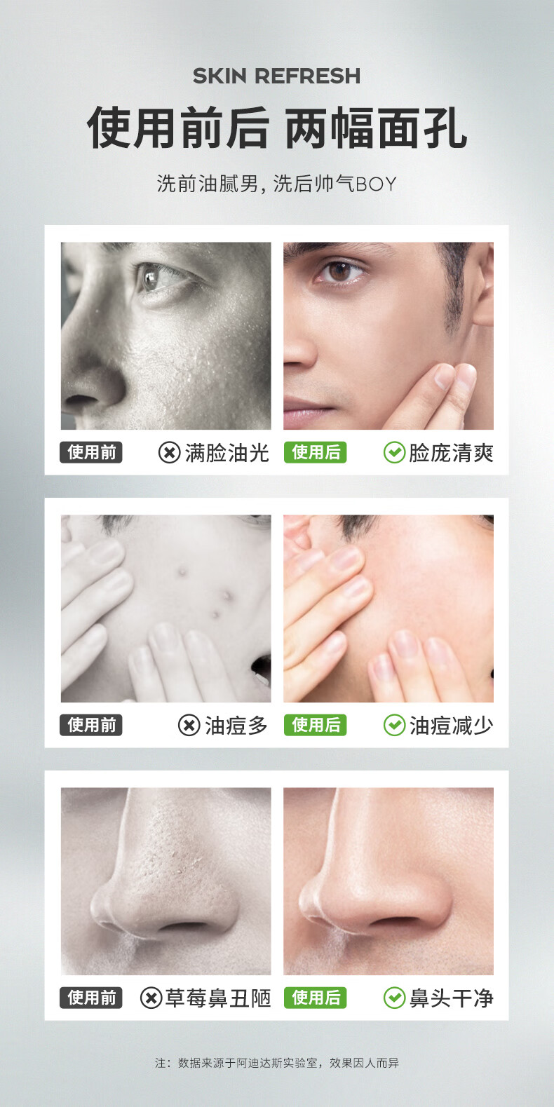 阿迪达斯（adidas）男士洗面奶洁面乳男控油深层清洁洁面膏控油洗面奶清洁毛孔去角质 激情沐浴露250*2+沐浴套盒