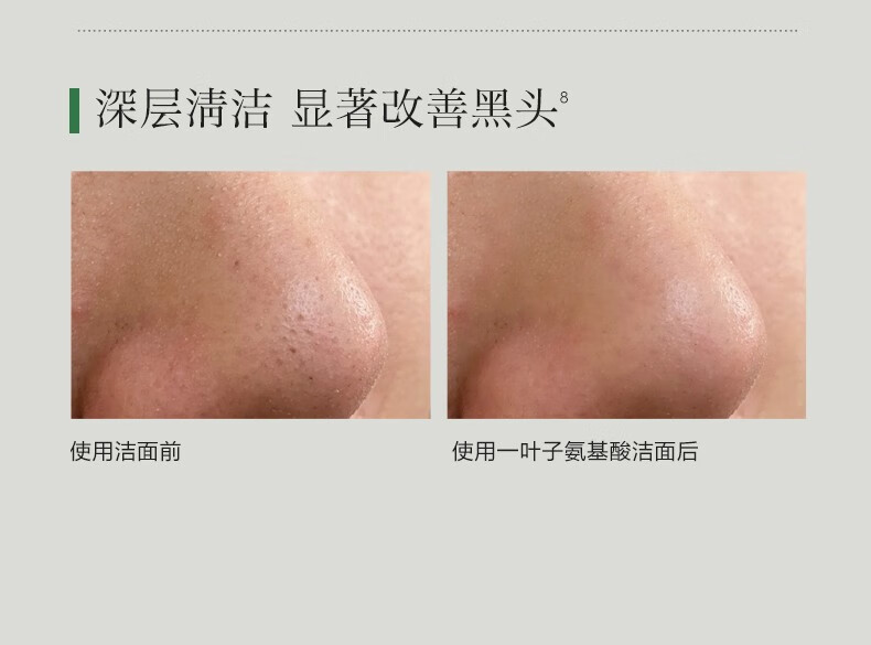 一叶子（One leaf）护肤品水乳套装补水保湿B5舒缓修护敏感肌改善泛红男女新年礼物 B5修护保湿3件套：洗面奶+水+乳